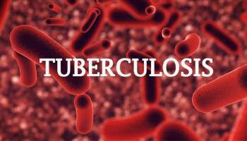 20252C5222BTuberculosis2Bpatients2Bin2BKano2Bhave2Bgone2B25E225802598missing25E225802599
