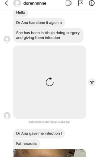 Cosmetic Surgeon, Dr Anu under fire as lady calls her out over failed surgery 1 d2