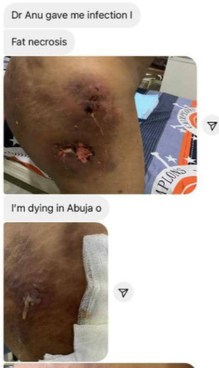 Cosmetic Surgeon, Dr Anu under fire as lady calls her out over failed surgery 2 d3