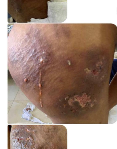 Cosmetic Surgeon, Dr Anu under fire as lady calls her out over failed surgery 4 d5