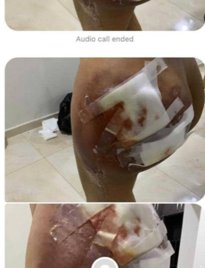 Cosmetic Surgeon, Dr Anu under fire as lady calls her out over failed surgery 5 d6