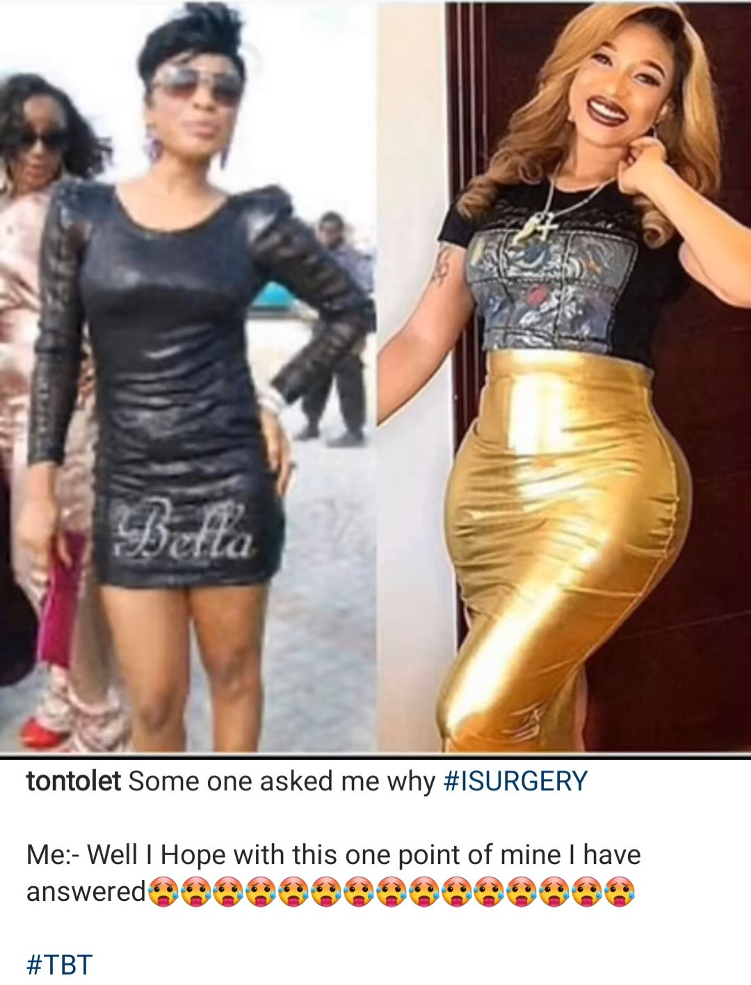 Tonto Dikeh Explains Why She Went Under The Knife Using Just Photos Lol, Nollywood actress and well, latest lovergirl in town, Tonto Dikeh has explained why she wnet through the knife to enhance her body, using just photographs. The actress had shared the two photos on his instagram page, saysing someone had asked her why she went under the knife, and she hopes this answers the person.