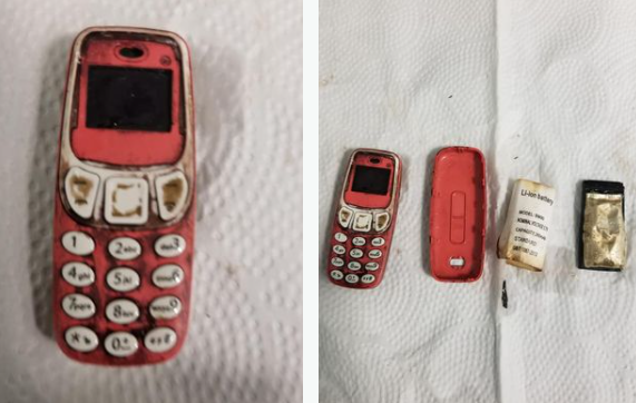 Man swallows entire Nokia 3310 phone - and has to undergo surgery to remove it 1 man