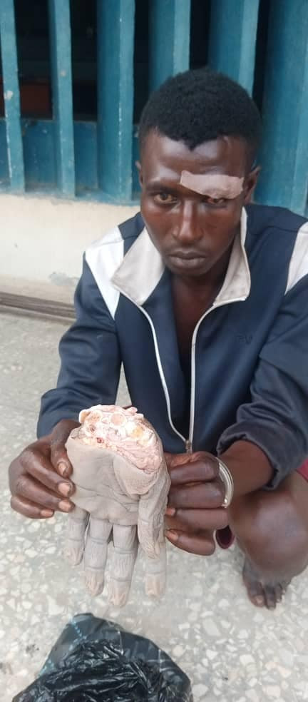 Man Cuts Another’s Wrist For Insulting Girlfriend