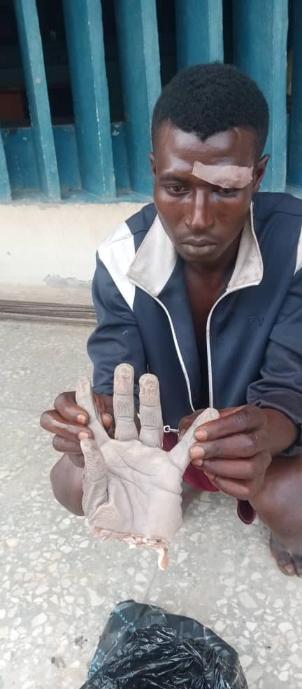 Man Cuts Another’s Wrist For Insulting Girlfriend